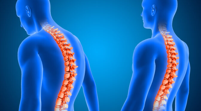Spinal Cord Stimulation for Chronic Pain: Patient Benefits and Results 