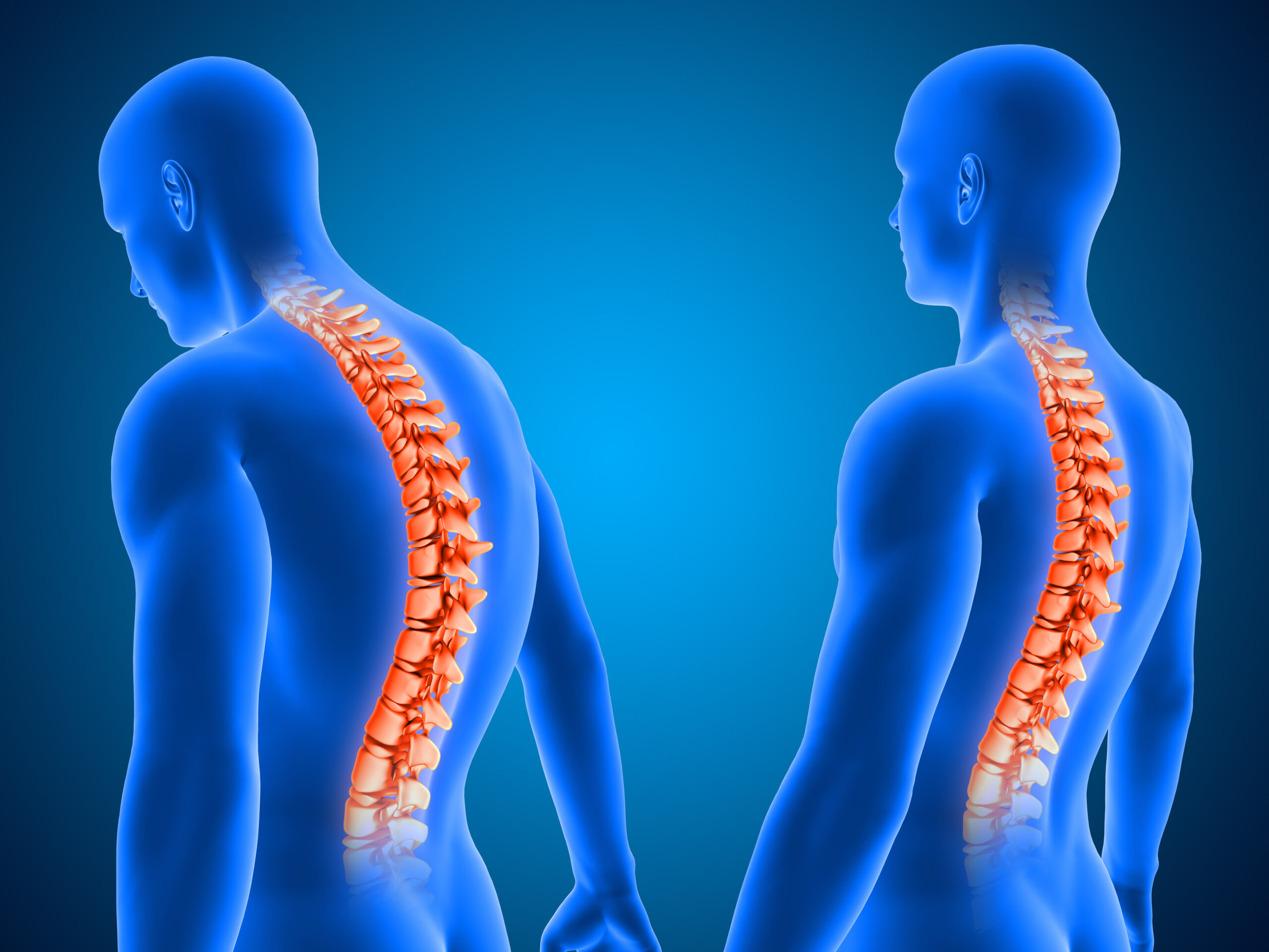 Spinal Cord Stimulation for Chronic Pain: Patient Benefits and Results 