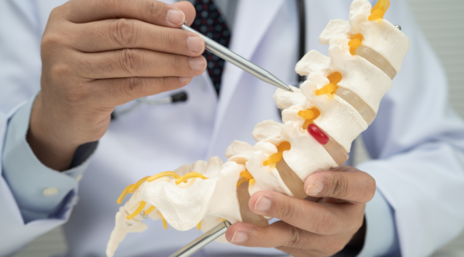 Foraminotomy Procedure: Benefits, Risks, and Recovery Timeline 