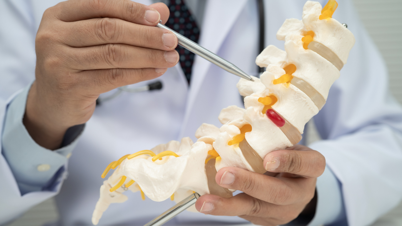 Foraminotomy Procedure: Benefits, Risks, and Recovery Timeline 