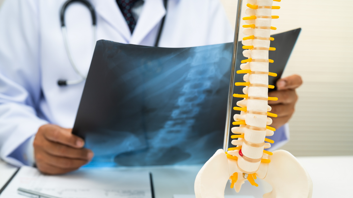 Intrathecal Pain Pumps: Advanced Treatment for Severe Chronic Pain 