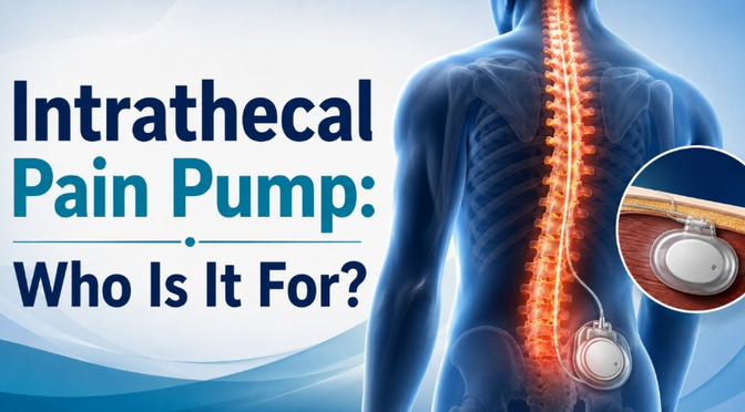 Intrathecal Pain Pump: Who Is It For? 