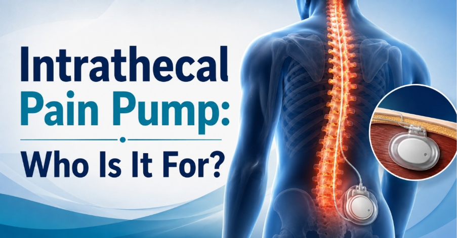 Intrathecal Pain Pump: Who Is It For? 